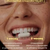 Инозитол мио 1500 мг для похудения 120 капсул — фото 7